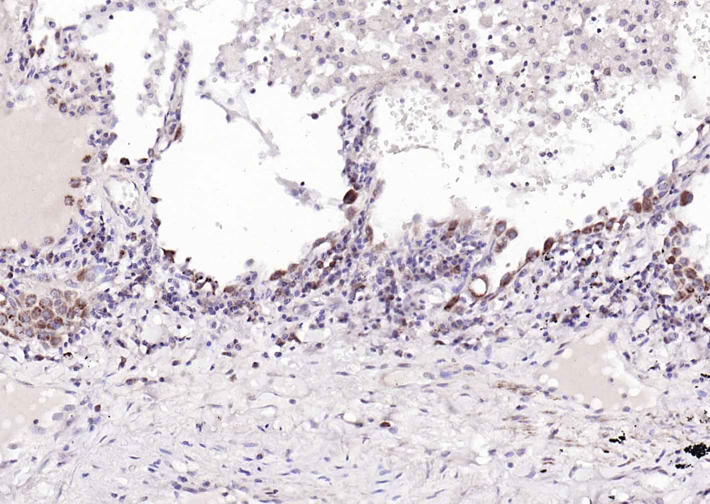 细胞色素C单克隆抗体-bsm-33193M